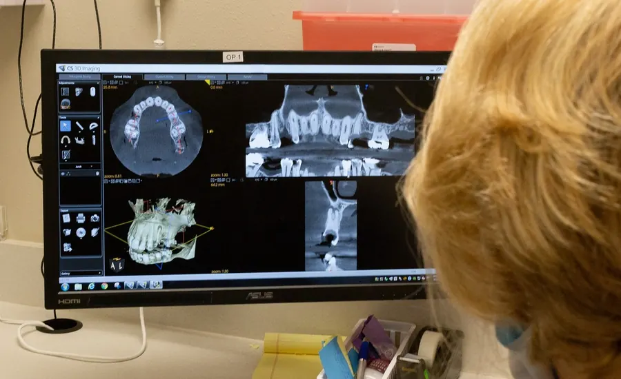 A 3-D x-ray scan of a patient's teeth and jaw on a Northshore Dental monitor.